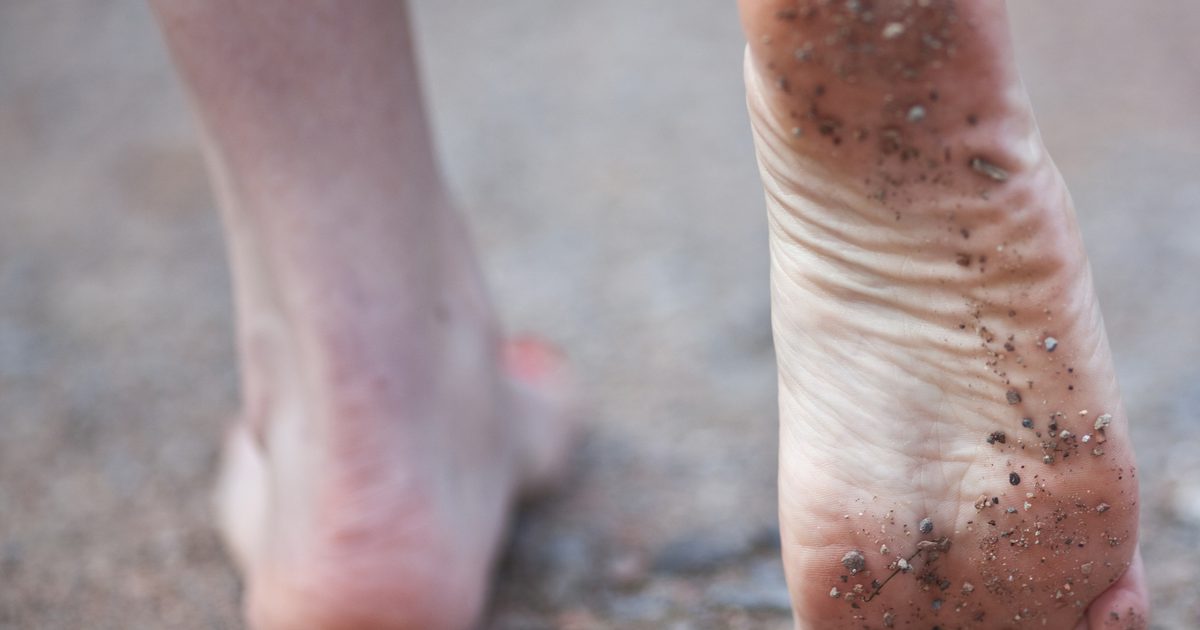 Fissures & Athletes Feet Treatment
