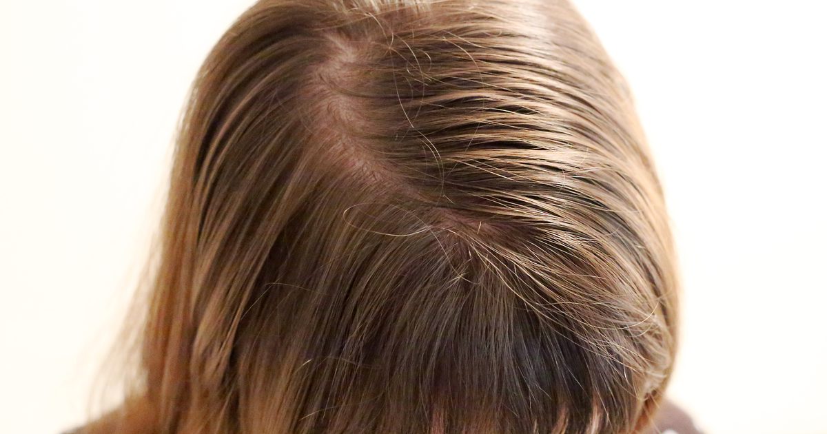 Pielęgnacja włosów Porady dla cienkich, cienkich, przetłuszczających się włosów