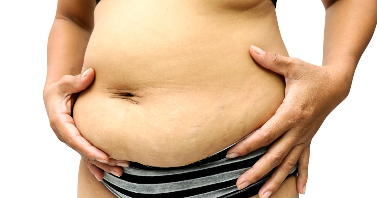 Ako sa ženy zbavia tukových roliek a jazvových tkanív?