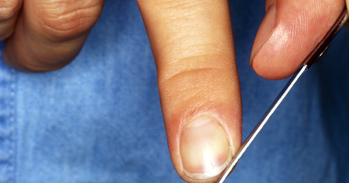 Как да се грижим за кожата След като ноктите паднат