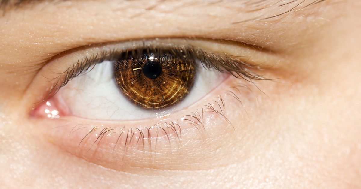 Hvordan Diagnose Puffy Eyelids som ikke vil gå bort