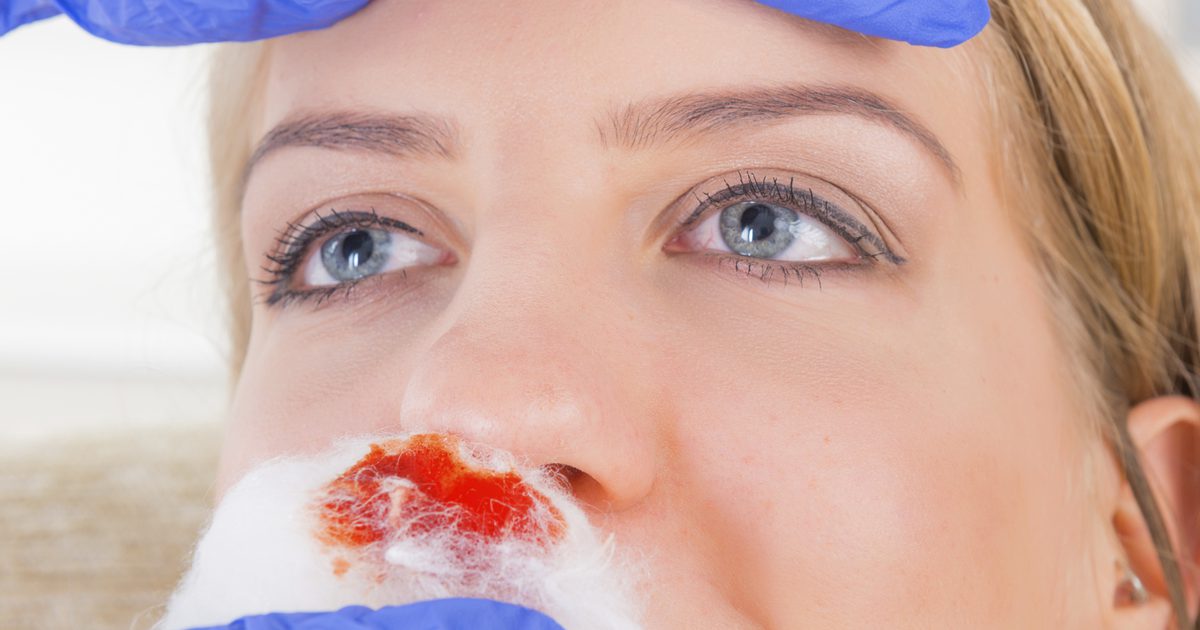 Hvordan bli kvitt en bump i nesen din