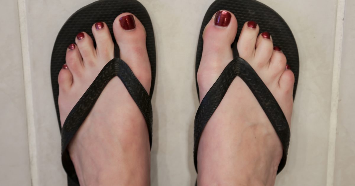 Hur bli av med illaluktande fötter från sandaler