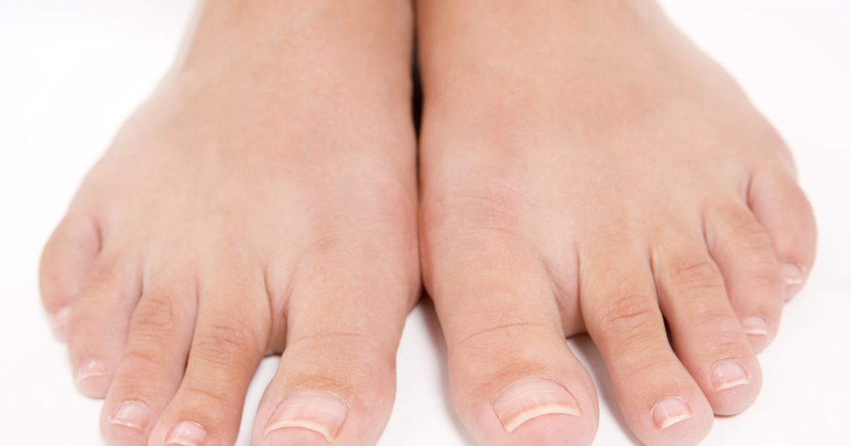 Hur bli av med tjock hud under toenailsna