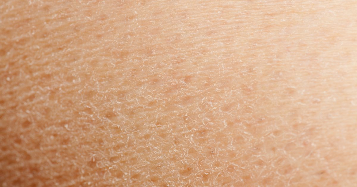 Jak zlepšit extrémně suchou pokožku