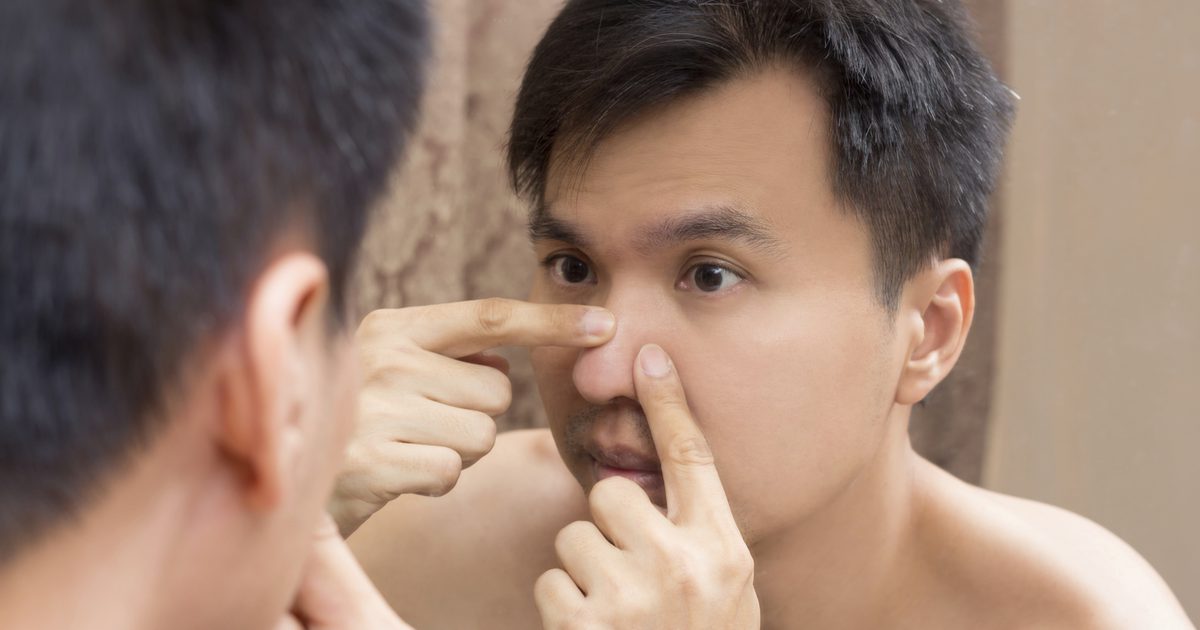 Kako pop pimples na nosu