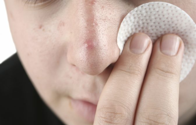 Hvordan man reducerer acne og store porer