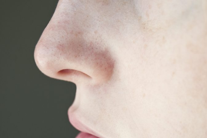 Как да премахнете запушени пори на носа