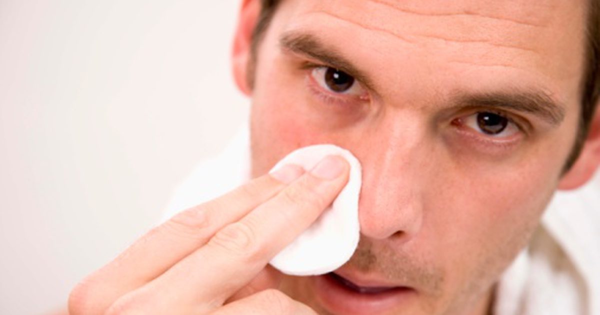 Kako prenehati akne na nosu