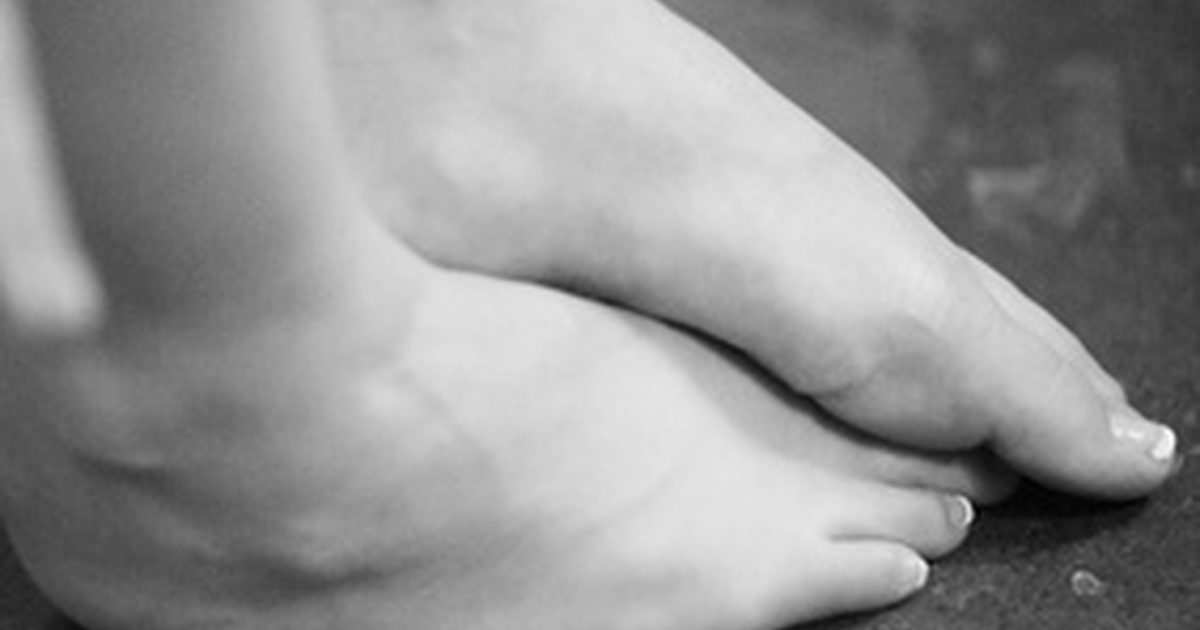 Hur man behandlar torr, sprickad och peeling fötter naturligt