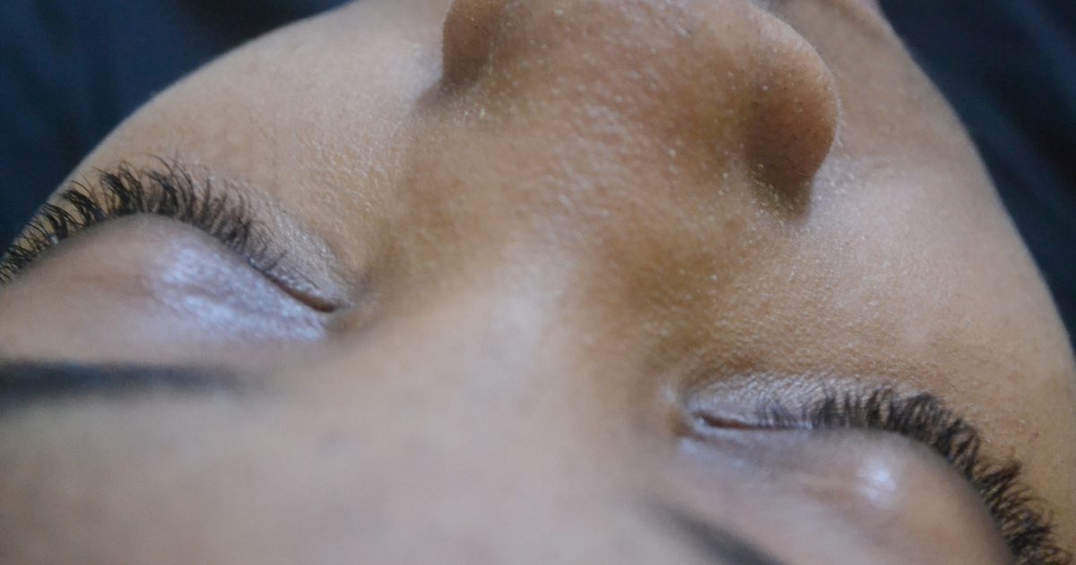 अफ्रीकी अमेरिकी चेहरे पर डार्क स्पॉट को हटा रहा है