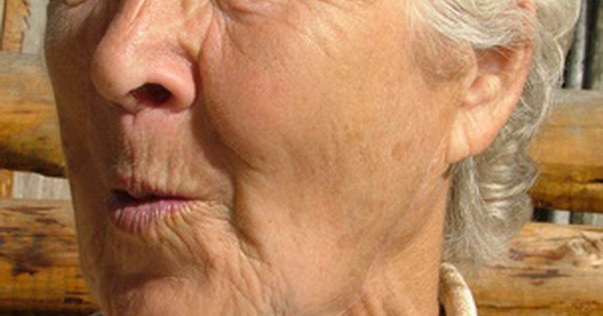 Hva er årsakene til akneoppgang i kvinne over 60 år?