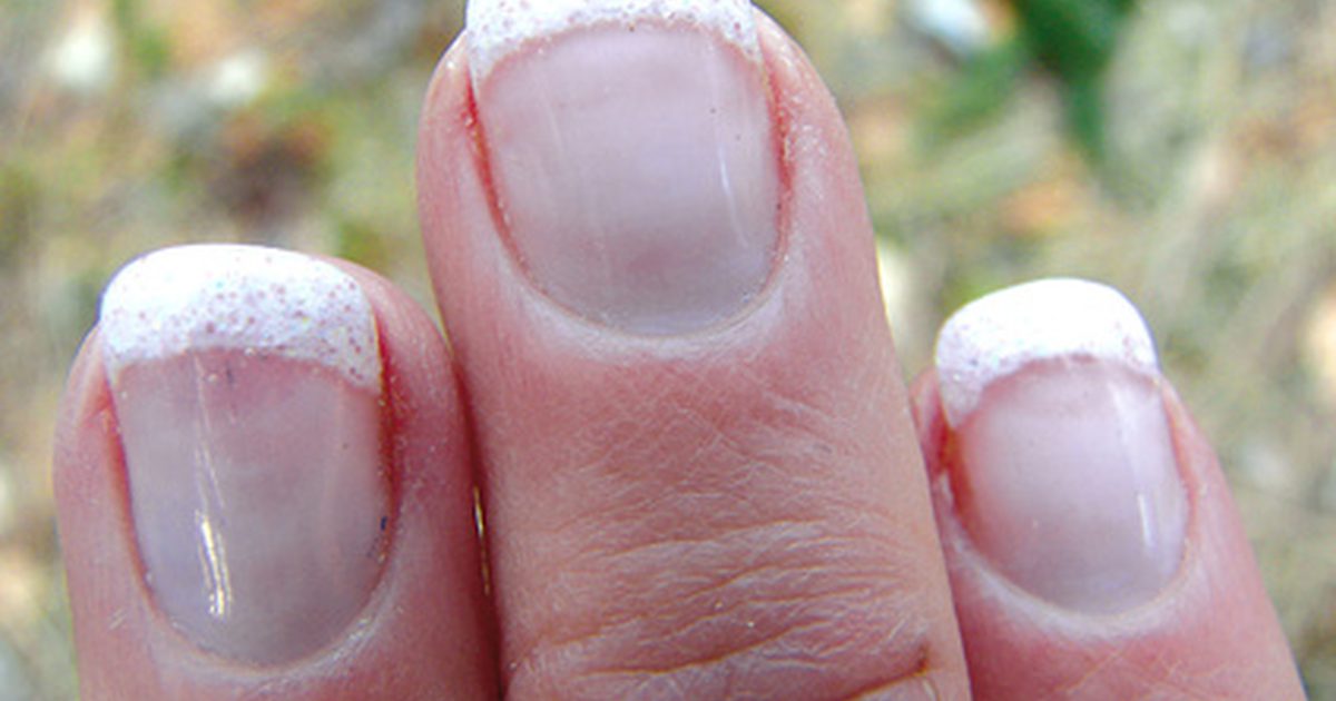 Каковы причины хрупких ногтей, которые взламывают и разделяют?
