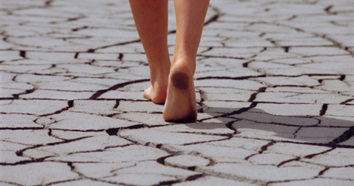 Jakie są przyczyny nagłych suchych stóp?