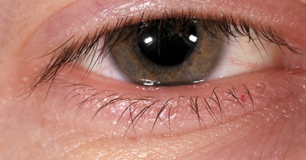 Jaké jsou příčiny otoků očí a obličeje?