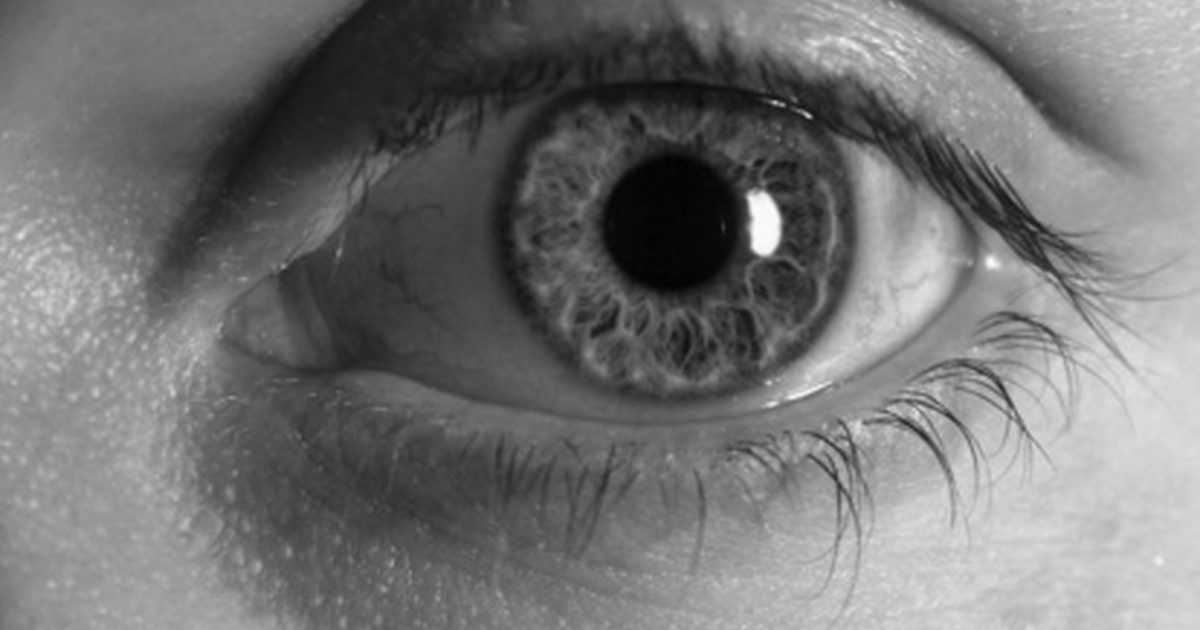 Vad är behandlingarna för ett mörkt ögat?