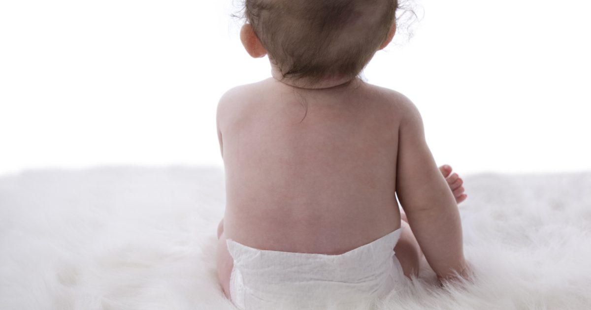 Was kann helfen, Narben bei Babys zu verblassen?