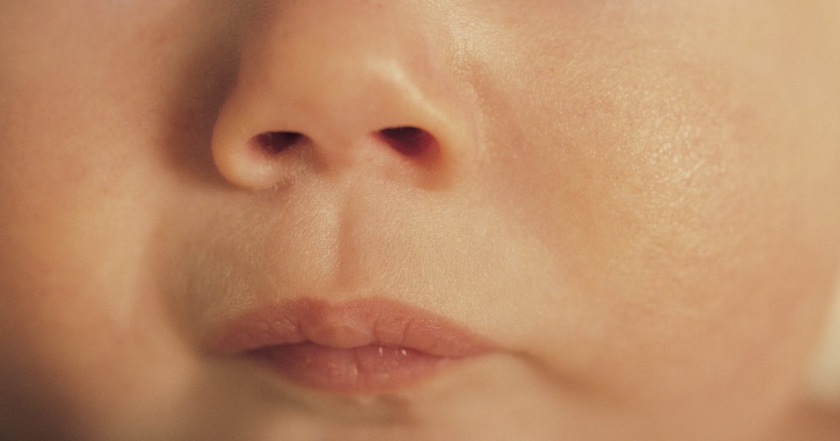 Was kann ich unter die Nase eines Babys tun, um mit der trockenen Haut von einer Erkältung zu helfen?