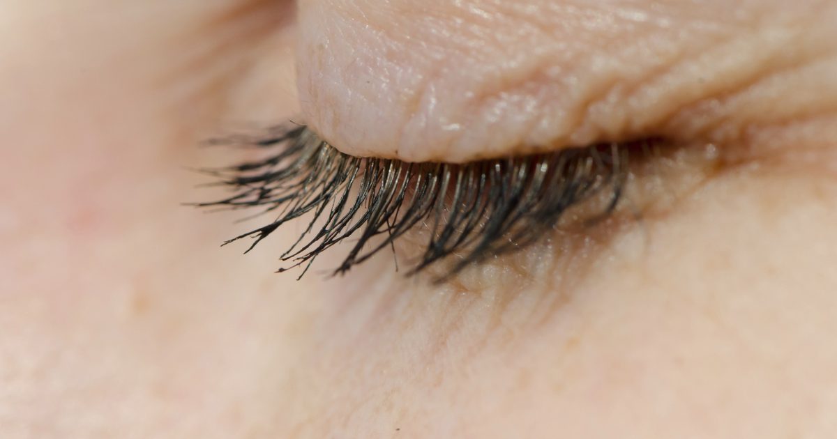 Hva forårsaker øyelokket å rynke?