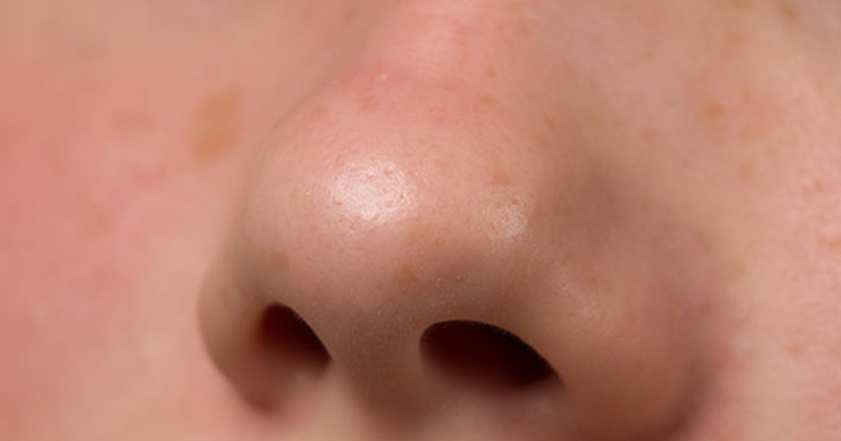 Какво причинява пъпки в носа ви?