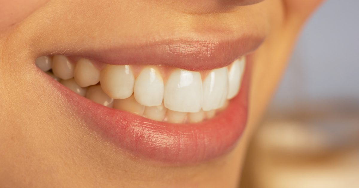 Zijn er voedingsmiddelen die tanden bleken?