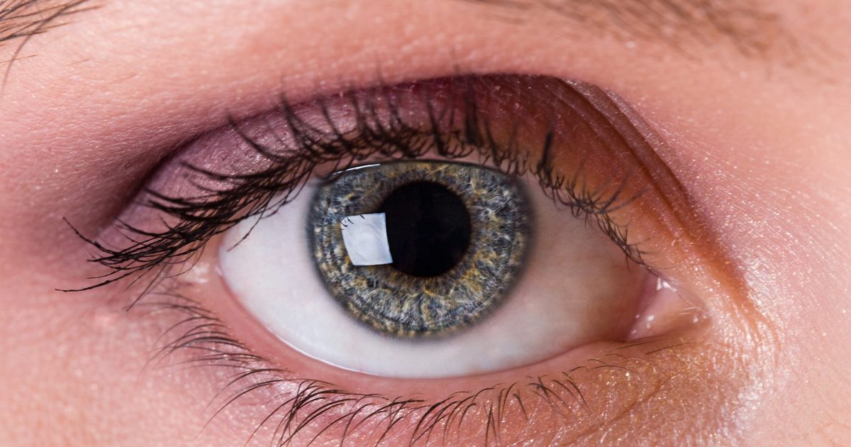 Может ли дефицит витамина B-12 вызвать окунание глаз?