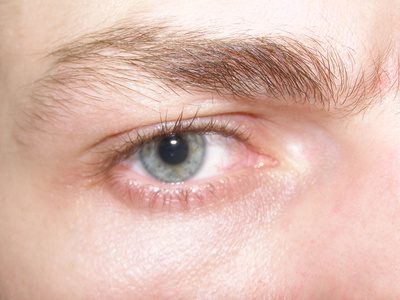 Kan vitamin D3 hjælpe tørre øjne?