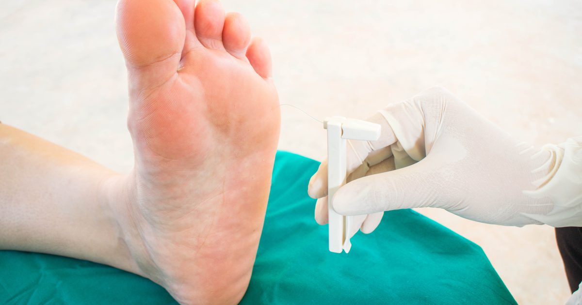 Hilft Folsäure Neuropathie in den Füßen?