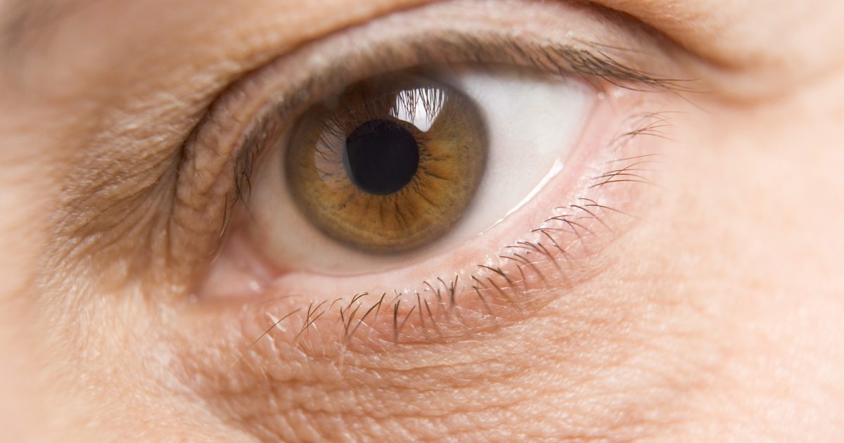 Gør en Magnesiummangel forårsaget af øjetrykning?
