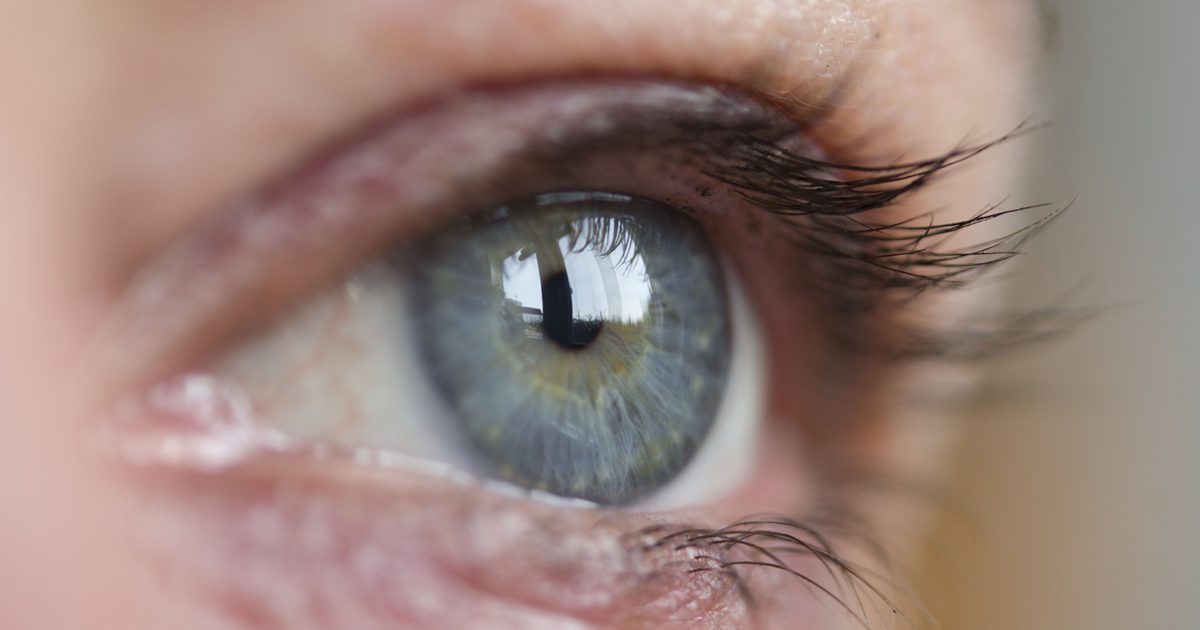 Сухие глаза от дефицита витамина А