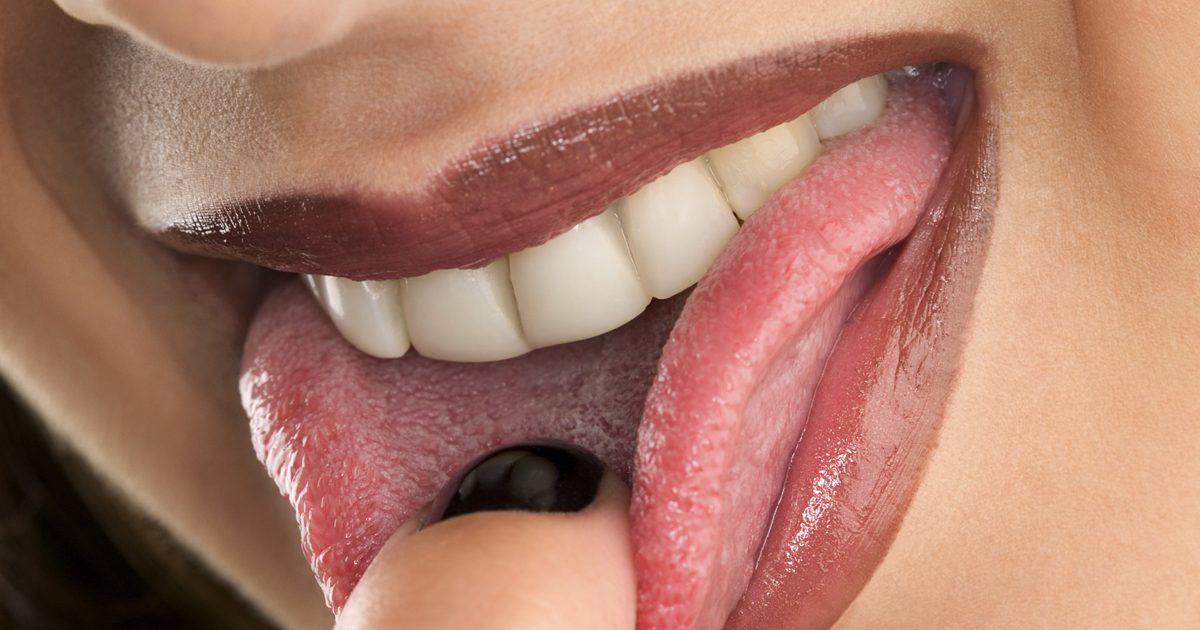 Symptome von Vitamin B12-Mangel an der Zunge