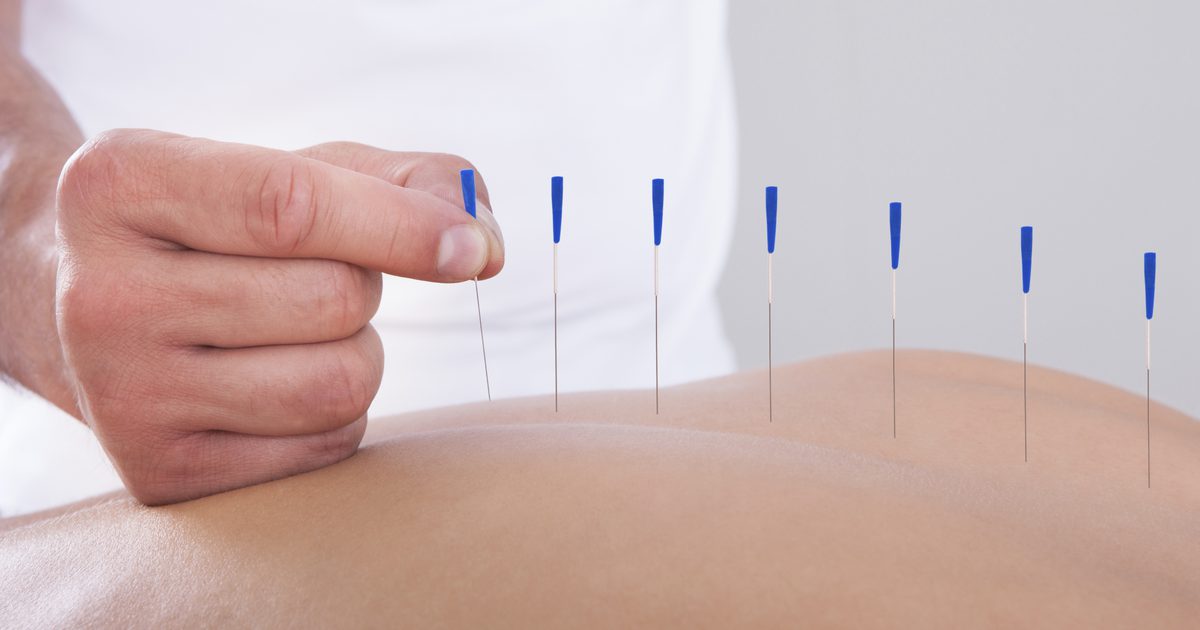 Akupunktur för nervregeneration