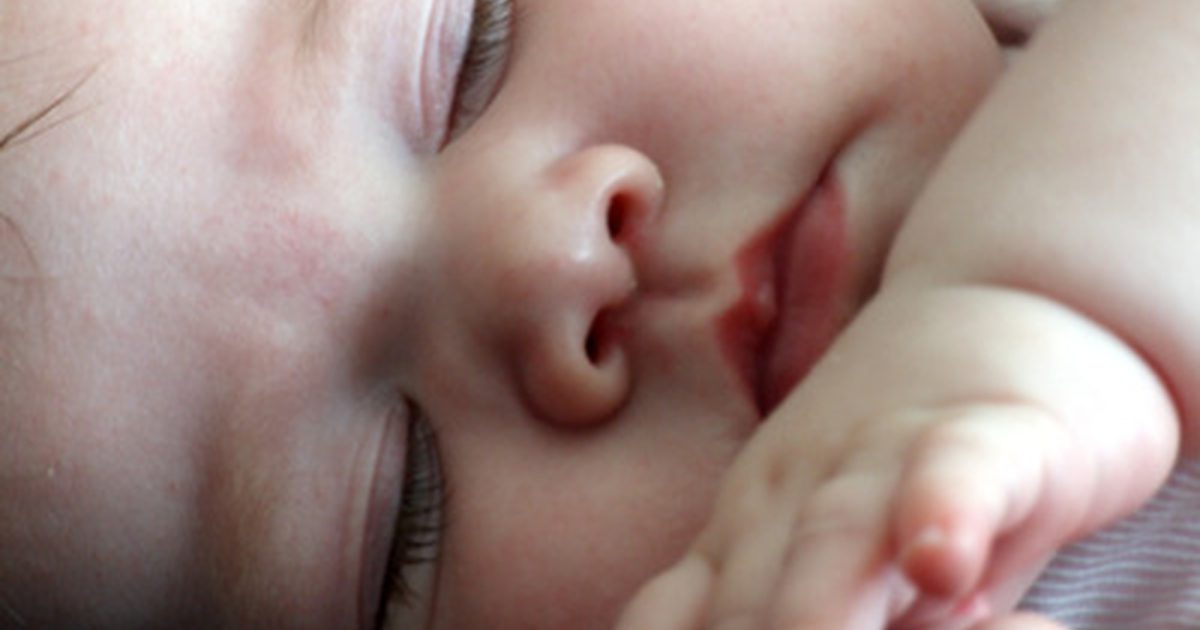 Różnice między trądzikiem niemowlęcym a Milią
