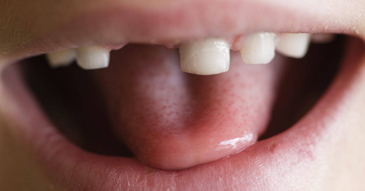 Účinky vytahování dětských zubů