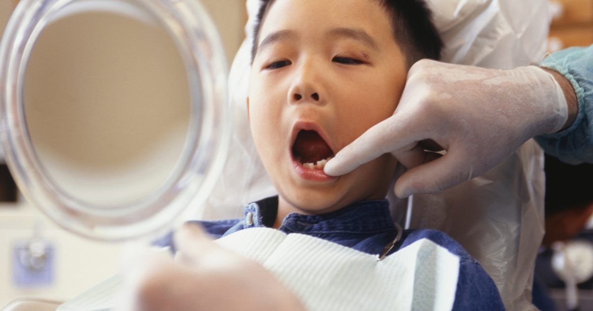 Извличане на зъби при деца