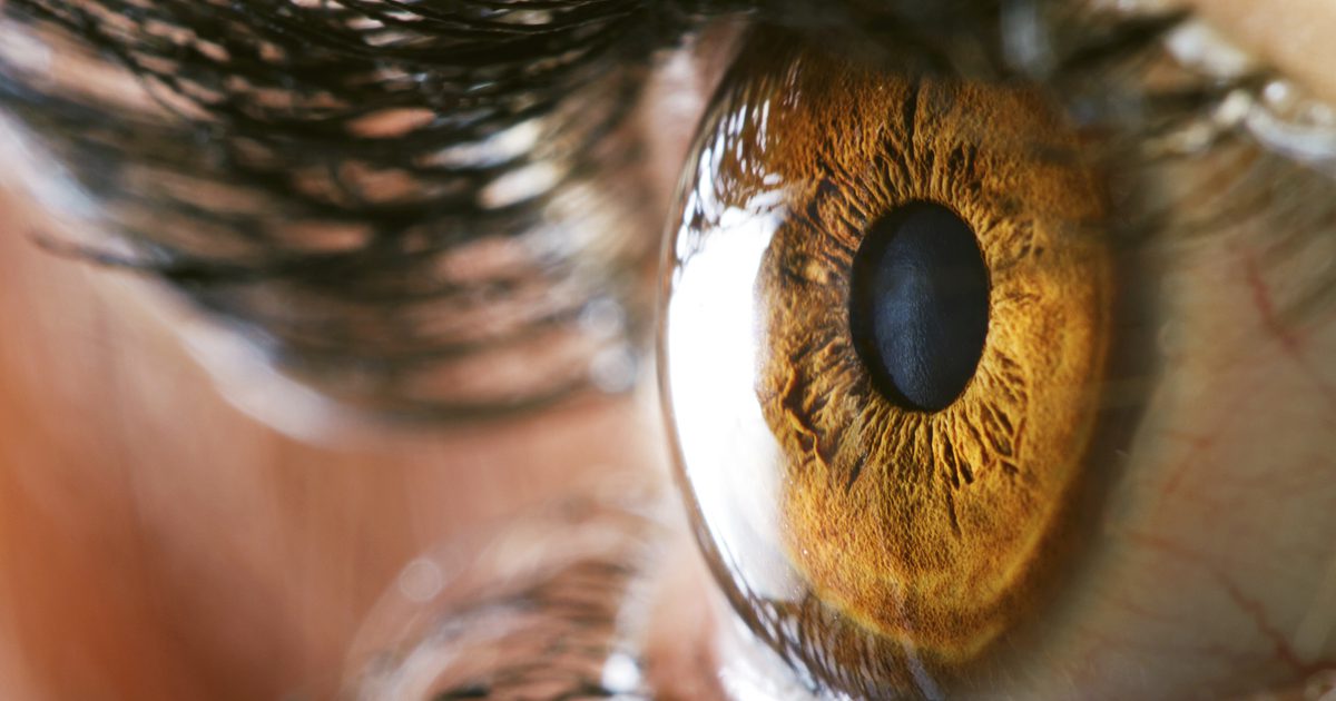Visoki učinki holesterola na oči