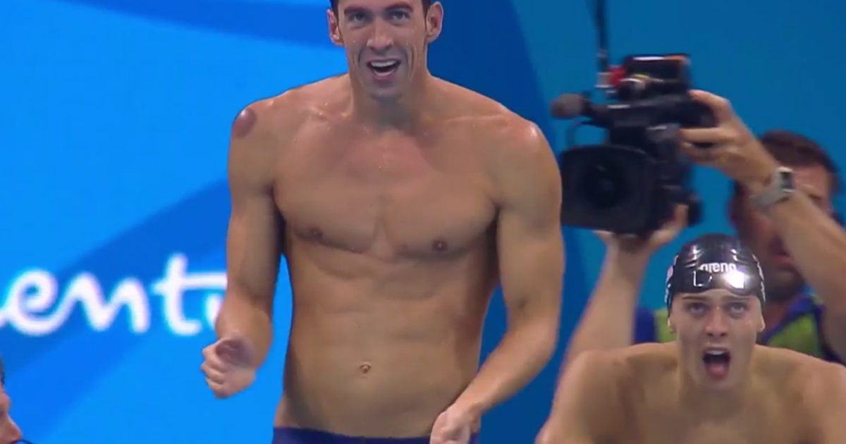 Hoe kreeg Michael Phelps die enge blauwe plekken op zijn huid?