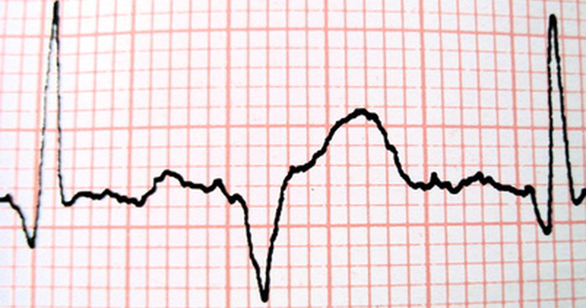 Jak czytać Blood Pressure & Heart Monitor w szpitalnym łóżku