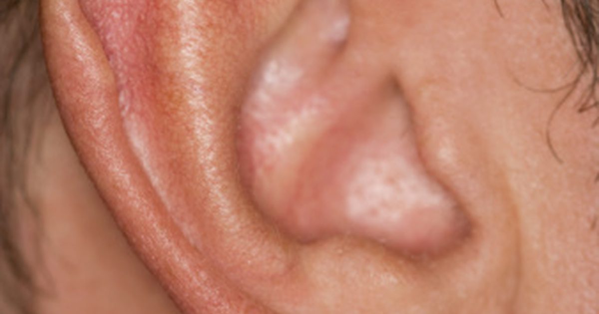 Pimple v uchu kanál