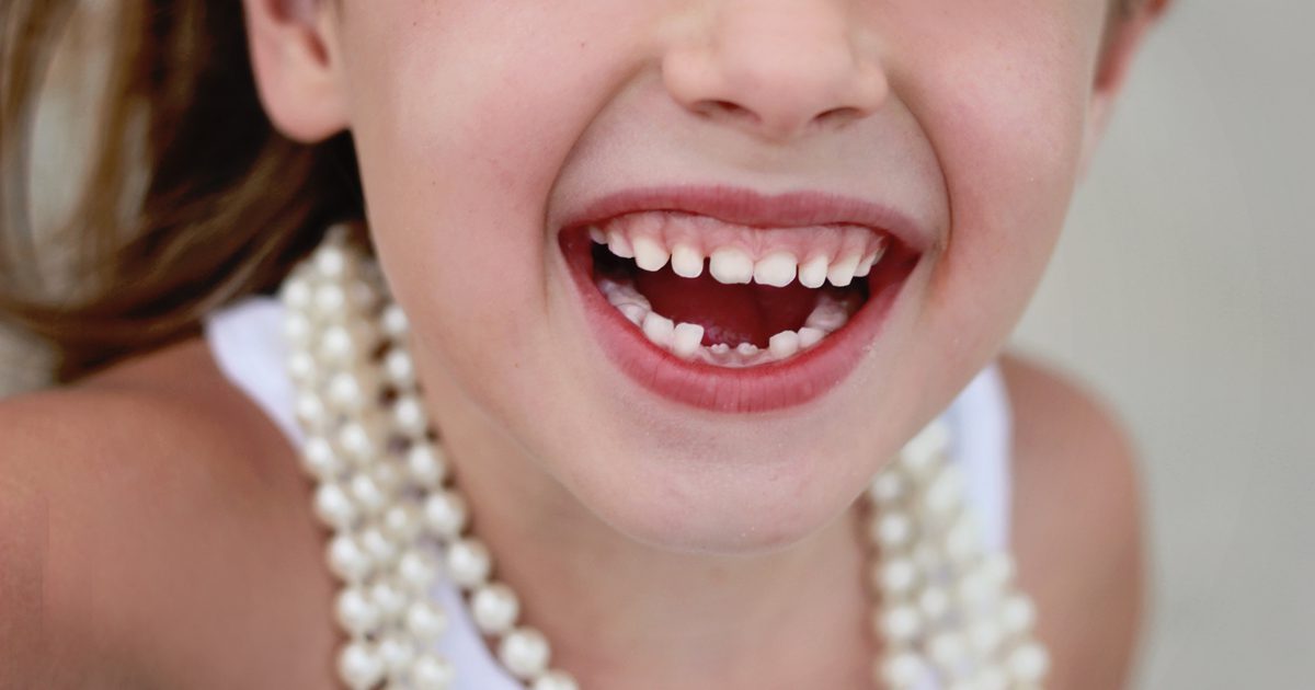 Dôvody, prečo dieťa zuby neprídu