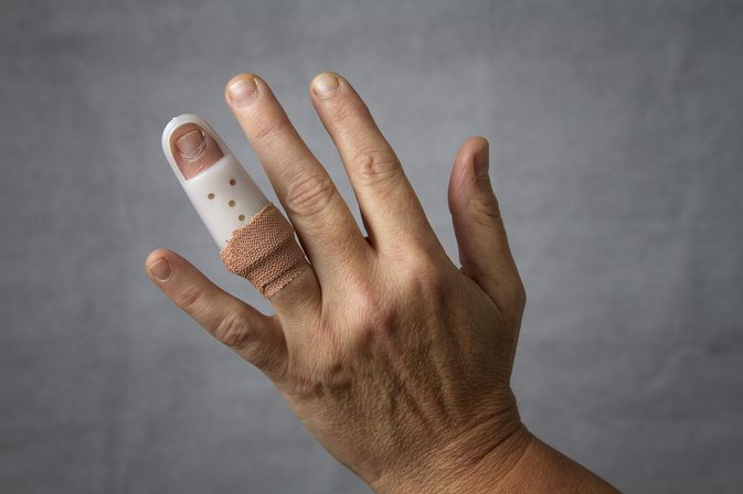 Herstel van vingerkchirurgie