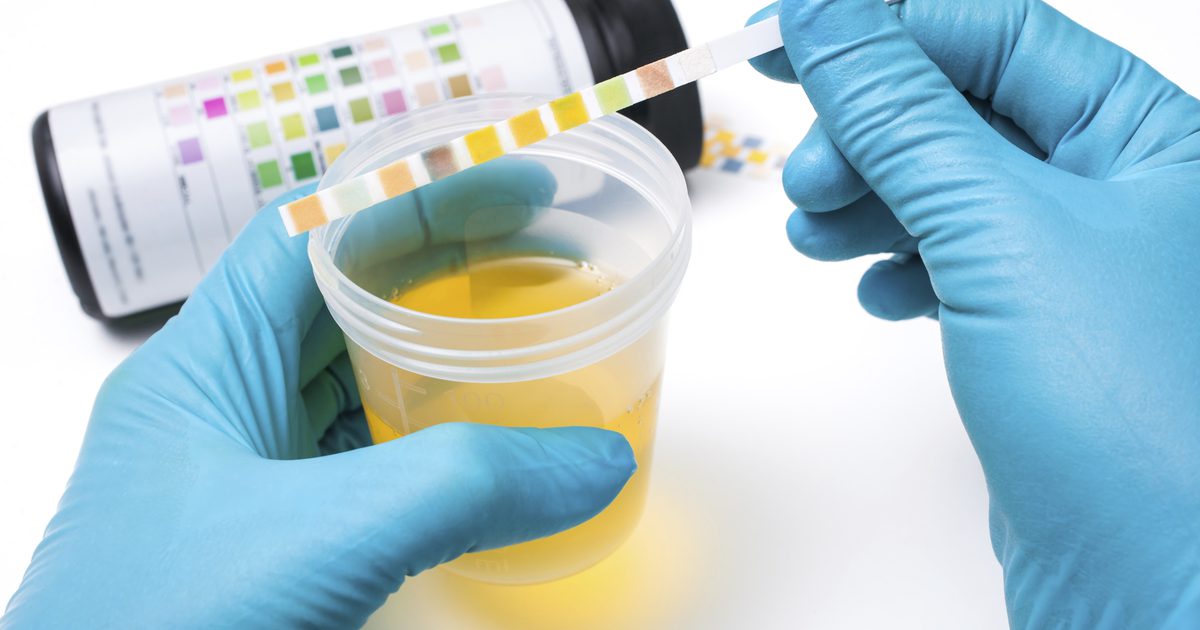 Wat zijn de factoren die de pH van de urine beïnvloeden?