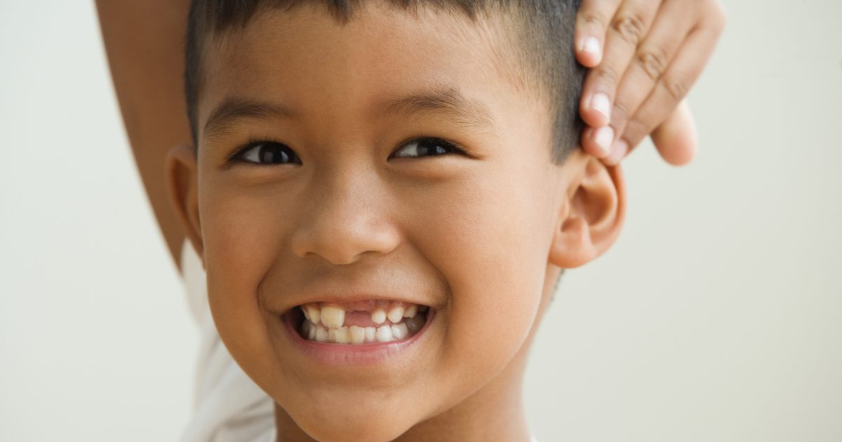 ما الذي يسبب الأسود على أسنان الأطفال؟
