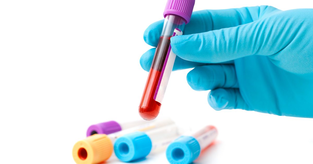रक्त परीक्षण में विटामिन डी के लिए सामान्य रेंज क्या है?