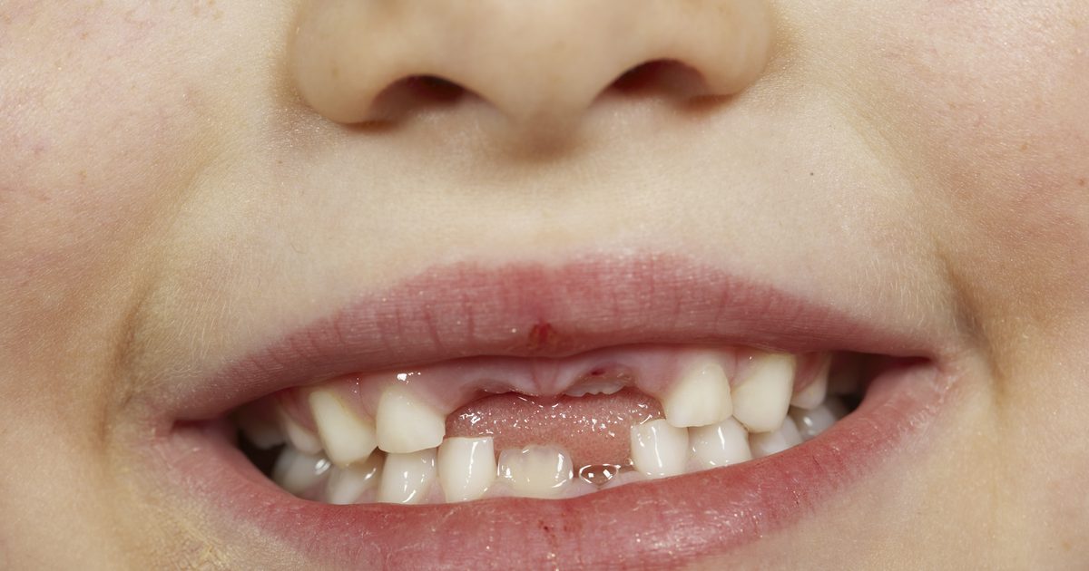 Hvor lang tid ophører børn med at tro på tandfoden?