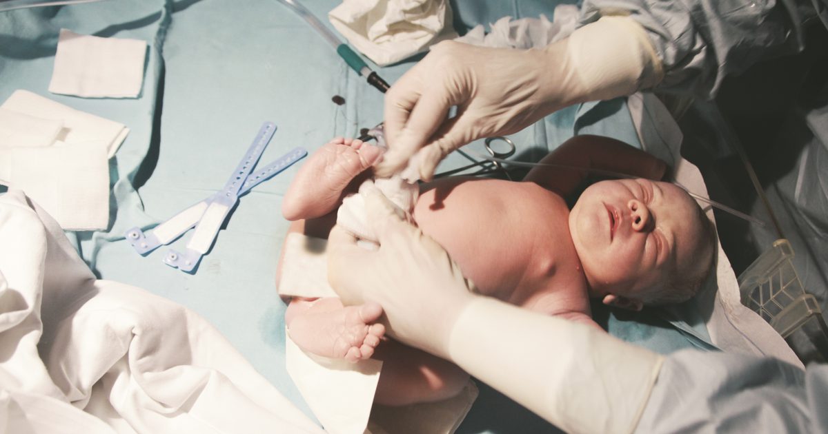 Navelverkleuring in een pasgeborene