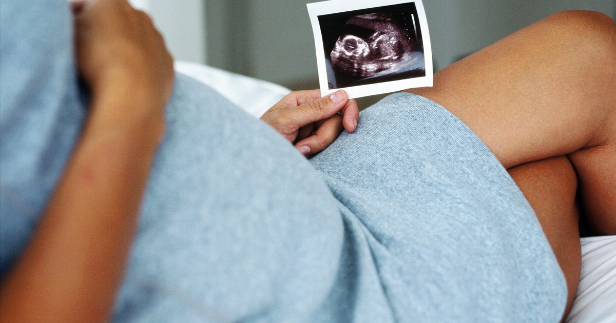 Rozvoj kostí počas vývoja plodu