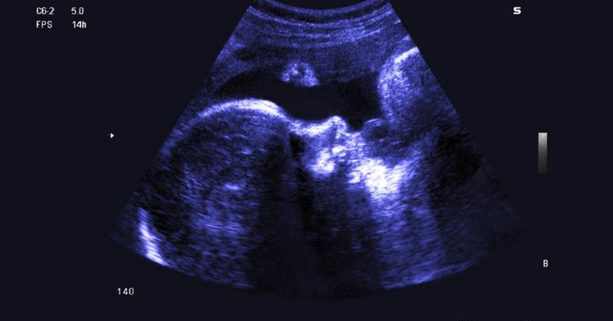 مراحل تطور الطفل في الرحم