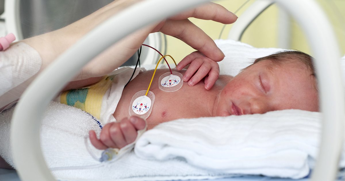 Запек в новородените Preemie