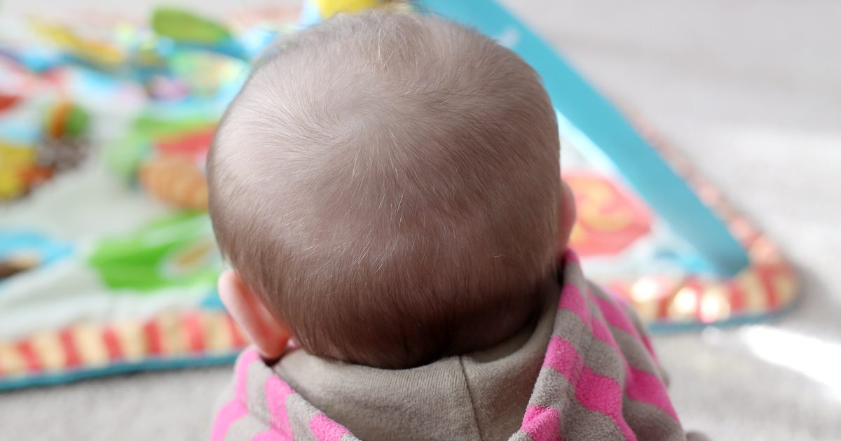 Wie man verhindert, dass sich ein kahler Fleck auf dem Rücken eines Babykopfes entwickelt